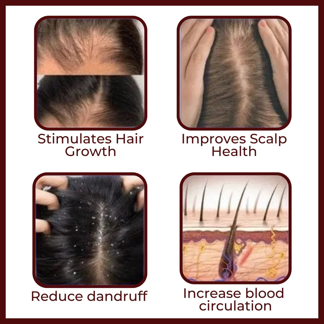 Nanofog therapy massage comb for hair growth
Hair scalp massage comb for anti hair loss
Scalp therapy massage comb device