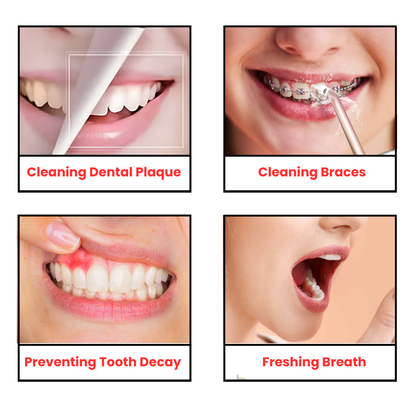 Oral irrigator water flosser for teeth and gums
Dental water flosser for braces
Portable water flosser device